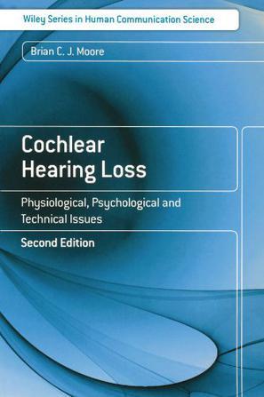 Cochlear hearing loss：physiological, psychological and technical issues