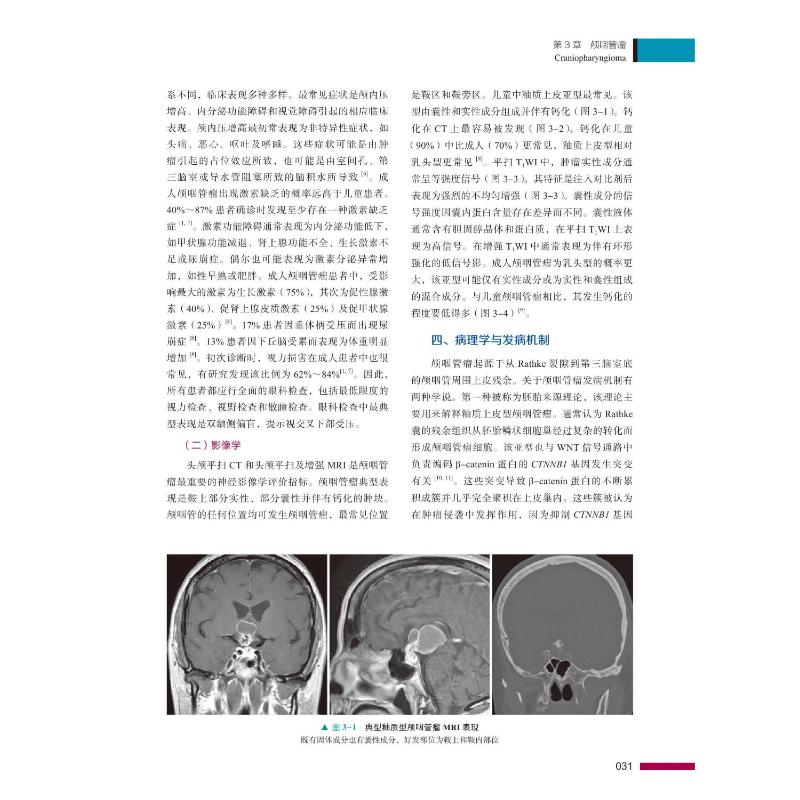 成人中枢神经系统肿瘤放射治疗学：从理论到实践