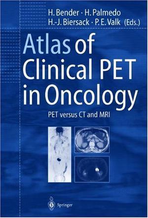  The Ultimate Guide to PET CT Scanners: Understanding Their Importance in Modern Medical Imaging