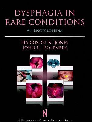 Dysphagia in rare conditions：an encyclopedia