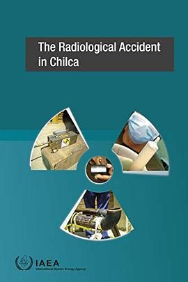 The radiological accident in Chilca.