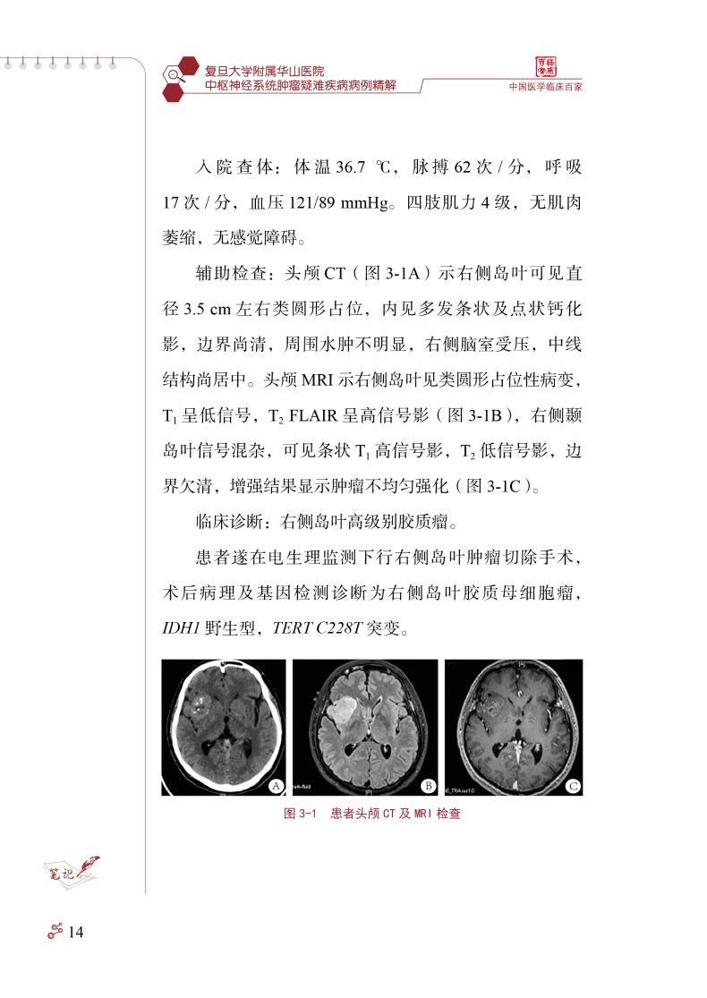 复旦大学附属华山医院中枢神经系统肿瘤疑难疾病病例精解