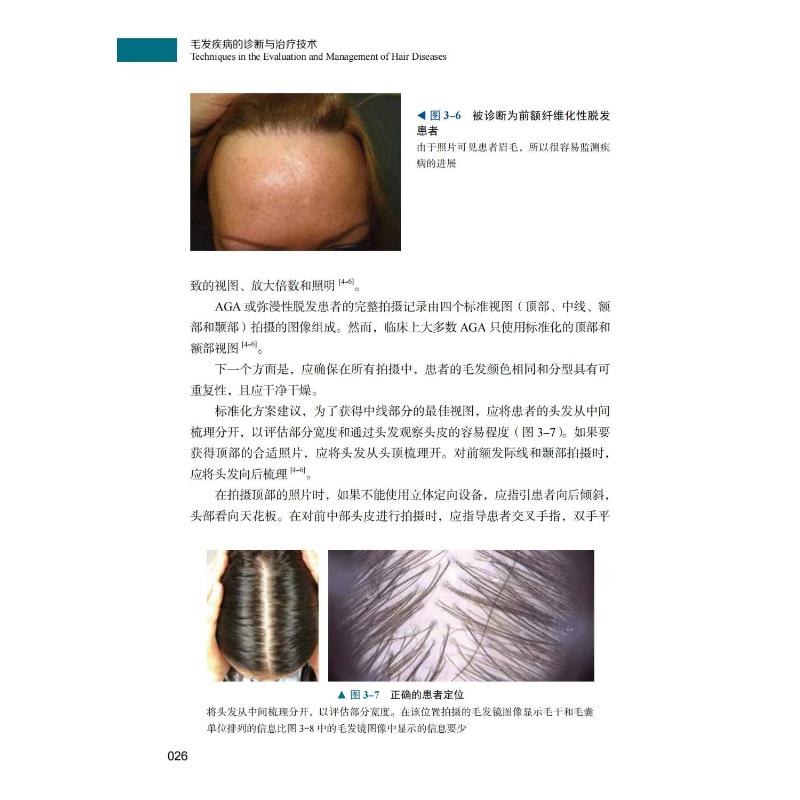 毛发疾病的诊断与治疗技术 皮肤、性病及精神病学