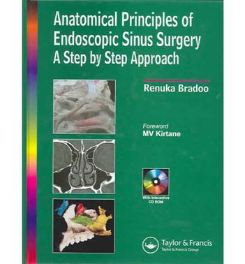 Anatomical principles of endoscopic sinus surgery：a step by step approach