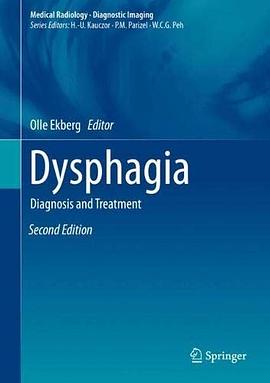Dysphagia : diagnosis and treatment