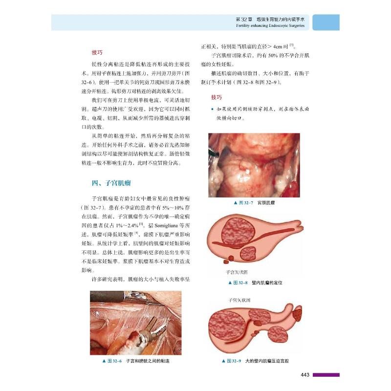 腹腔镜与宫腔镜妇科手术学