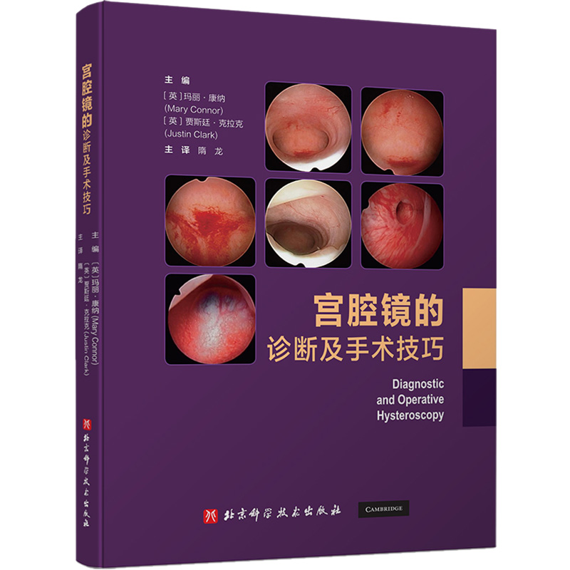 宫腔镜的诊断及手术技巧