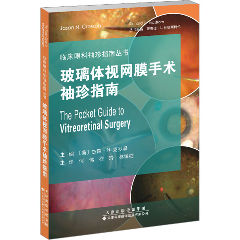 玻璃体视网膜手术袖珍指南 五官科